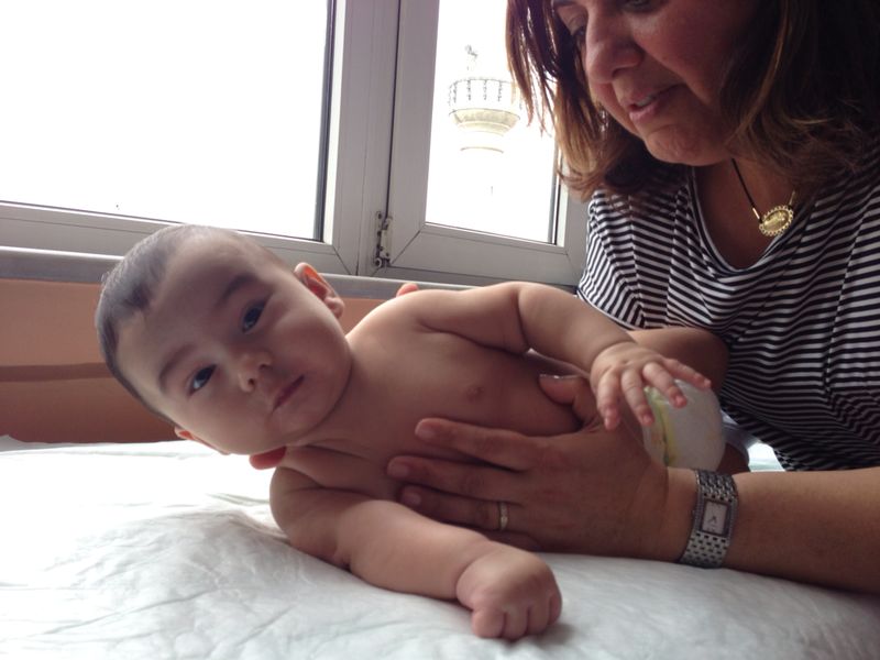 Doğuştan brakiyal pleksus yaralanmaları (Obstetrik Palsi)